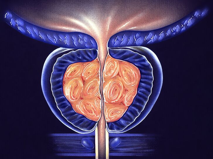 prevention of prostate inflammation and prostatitis